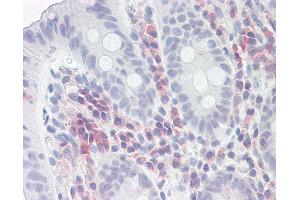 Immunohistochemistry (IHC) image for anti-Proteasome (Prosome, Macropain) Activator Subunit 1 (PA28 Alpha) (PSME1) (AA 72-121) antibody (ABIN6749766)