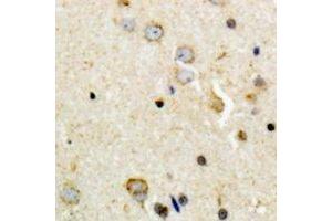 Immunohistochemical analysis of Tyrosine Hydroxylase (pS8) staining in human brain formalin fixed paraffin embedded tissue section. (Tyrosine Hydroxylase Antikörper  (N-Term, pSer8))