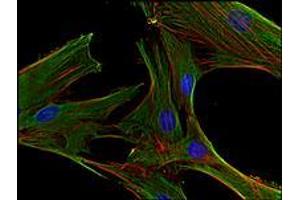 Immunofluorescence (IF) image for anti-Clathrin Heavy Chain (CLTC) (Heavy Chain) antibody (ABIN238388) (Clathrin Heavy Chain (CLTC) (Heavy Chain) Antikörper)