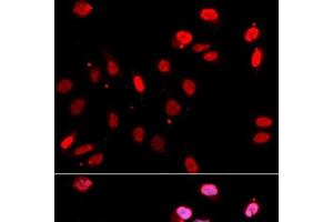 Immunofluorescence analysis of U2OS cells using RAD18 Polyclonal Antibody (RAD18 Antikörper)