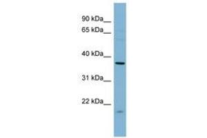 Image no. 1 for anti-Farnesyltransferase, CAAX Box, alpha (FNTA) (N-Term) antibody (ABIN6741792) (FNTA Antikörper  (N-Term))