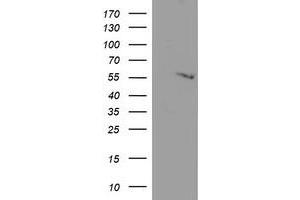 Western Blotting (WB) image for anti-Adipocyte Plasma Membrane Associated Protein (APMAP) antibody (ABIN1496663) (APMAP Antikörper)