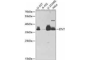 Western blot analysis of extracts of various cell lines, using ETV7 antibody (ABIN6132177, ABIN6140336, ABIN6140338 and ABIN6221858) at 1:1000 dilution. (ETV7 Antikörper  (AA 1-210))