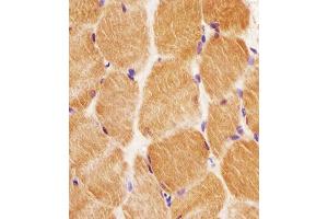 B staining GCLM in human skeletal muscle tissue sections by Immunohistochemistry (IHC-P - paraformaldehyde-fixed, paraffin-embedded sections). (GCLM Antikörper  (C-Term))