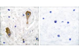 Peptide - +Immunohistochemical analysis of paraffin-embedded human brain tissue using GAD67 antibody.