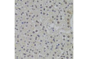 Immunohistochemistry of paraffin-embedded mouse liver using HNRNPA1 Antibody (ABIN5975570) at dilution of 1/100 (40x lens). (HNRNPA1 Antikörper)