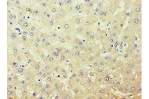 Immunohistochemistry of paraffin-embedded human liver tissue using ABIN7143588 at dilution of 1:100 (AKR7A3 Antikörper  (AA 1-331))