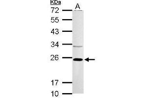 WB Image VHL antibody detects VHL protein by Western blot analysis. (VHL Antikörper)