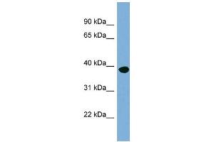 WB Suggested Anti-OAS1 Antibody Titration:  0. (OAS1 Antikörper  (N-Term))