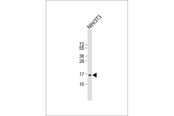 CDKN2C Antikörper  (C-Term)