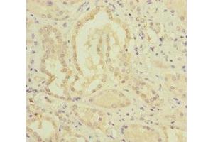Immunohistochemistry (IHC) image for anti-Methylmalonic Aciduria (Cobalamin Deficiency) CblC Type, with Homocystinuria (MMACHC) (AA 63-282) antibody (ABIN7159656)