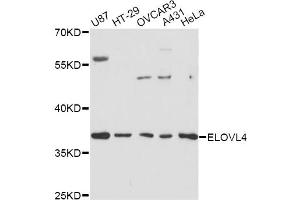 Western blot analysis of extracts of various cell lines, using ELOVL4 antibody. (ELOVL4 Antikörper)