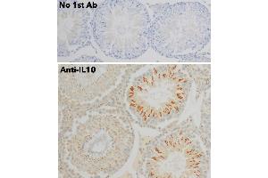 Immunohistochemistry (IHC) image for anti-Interleukin 10 (IL10) antibody (ABIN6254177) (IL-10 Antikörper)