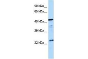 Image no. 1 for anti-Arginine Vasopressin Receptor 1B (AVPR1B) (C-Term) antibody (ABIN6747995) (AVPR1B Antikörper  (C-Term))