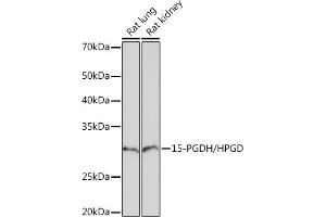 Western blot analysis of extracts of various cell lines, using 15-PGDH/HPGD Rabbit mAb (ABIN7267807) at 1:1000 dilution. (HPGD Antikörper)