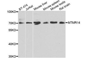 Western blot analysis of extracts of various cell lines, using MTMR14 antibody. (MTMR14 Antikörper)