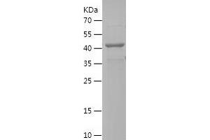 Western Blotting (WB) image for Elongator Acetyltransferase Complex Subunit 4 (ELP4) (AA 26-259) protein (His-IF2DI Tag) (ABIN7122764)