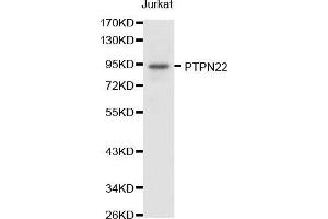 Western blot analysis of extracts of Jurkat cell lines, using PTPN22 antibody. (PTPN22 Antikörper  (AA 1-90))