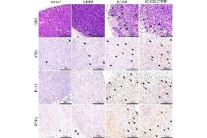 Immunohistochemistry (IHC) image for anti-CD8 (CD8) (AA 51-150) antibody (ABIN671391)