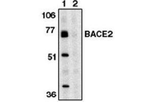 Image no. 1 for anti-beta-Site APP-Cleaving Enzyme 2 (BACE2) (AA 496-511) antibody (ABIN264997) (BACE2 Antikörper  (AA 496-511))