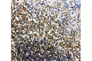 IHC-P: Bid antibody testing of rat spleen tissue (BID Antikörper  (C-Term))
