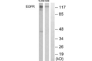 Western blot analysis of extracts from A549, HeLa and HepG2 cells, using EGFR antibody.