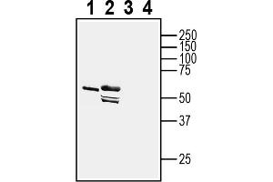 1-2. (Adiponectin Receptor 1 Antikörper  (Intracellular, N-Term))