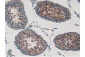 IHC-P analysis of Rat Testis Tissue, with DAB staining. (SFTPB Antikörper  (AA 111-329))