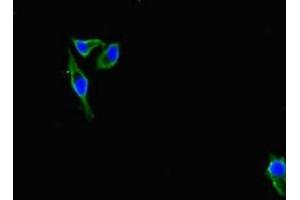 Immunofluorescent analysis of Hela cells using ABIN7156691 at dilution of 1:100 and Alexa Fluor 488-congugated AffiniPure Goat Anti-Rabbit IgG(H+L) (IFITM5 Antikörper  (AA 1-36))