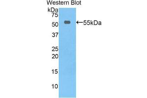 Western Blotting (WB) image for anti-Thymidine Phosphorylase (TYMP) (AA 33-290) antibody (ABIN3207502) (Thymidine Phosphorylase Antikörper  (AA 33-290))