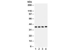 Western blot testing of 1) human placenta, 2) HeLa, 3) HUT and 4) Jurkat lysate with PINX1 antibody. (PINX1 Antikörper)