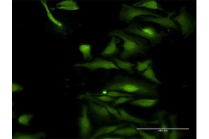 Immunofluorescence of purified MaxPab antibody to TRIM35 on HeLa cell. (TRIM35 Antikörper  (AA 1-493))