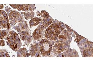 Immunohistochemistry (IHC) image for anti-Guanine Nucleotide Binding Protein (G Protein), alpha 11 (Gq Class) (GNA11) (Internal Region) antibody (ABIN6262007)