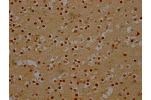 IHC image of ABIN7127452 diluted at 1:100 and staining in paraffin-embedded human brain tissue performed on a Leica BondTM system. (Rekombinanter DDX6 Antikörper)