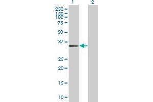 ZC3H14 Antikörper  (AA 1-306)