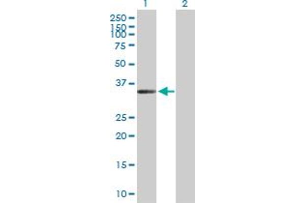 ZC3H14 Antikörper  (AA 1-306)