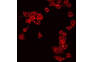 ABIN6275256 staining COLO205 by IF/ICC. (MEGF9 Antikörper  (Internal Region))