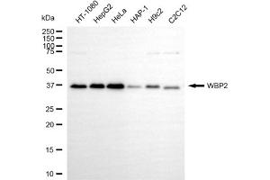 Western blotting analysis using WBP2 antibody (ABIN7800868). (WBP2 Antikörper)