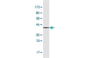 Western Blot detection against Immunogen (37. (GBF1 Antikörper  (AA 101-209))