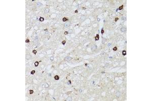 Immunohistochemistry of paraffin-embedded rat brain using MIP antibody (ABIN3016917, ABIN3016918, ABIN3016919 and ABIN6219879) at dilution of 1:100 (40x lens). (Mip (AA 50-150) Antikörper)