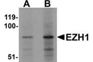Western blot analysis of EZH1 in mouse lung tissue lysate with EZH1 antibody at (A) 1 and (B) 2 μg/ml.