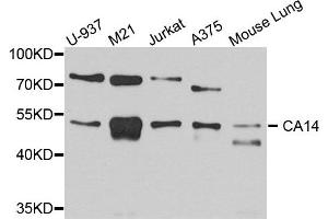 Western blot analysis of extract of various cells, using CA14 antibody. (CA14 Antikörper)