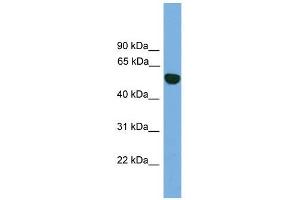 EPHX1 antibody used at 1 ug/ml to detect target protein. (EPHX1 Antikörper)