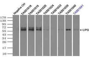Image no. 2 for anti-Lipase, Endothelial (LIPG) antibody (ABIN1499167)