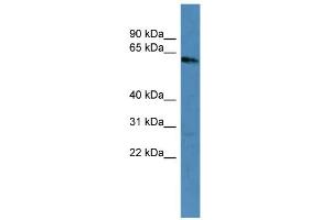 WB Suggested Anti-KRT3 Antibody Titration: 0. (Keratin 3 Antikörper  (C-Term))