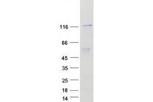 Western Blotting (WB) image for N-Acetyltransferase 10 (GCN5-Related) (NAT10) (Transcript Variant 1) protein (Myc-DYKDDDDK Tag) (ABIN2726845)