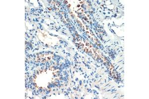 Immunohistochemistry of paraffin-embedded mouse lung using RPS6K antibody (ABIN6129296, ABIN6147232, ABIN6147233 and ABIN6214270) at dilution of 1:200 (40x lens). (MSK2 Antikörper  (AA 1-220))
