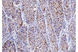 IHC analysis of Cdk2 using anti-Cdk2 antibody (ABIN7602522). (CDK2 Antikörper  (AA 81-298))
