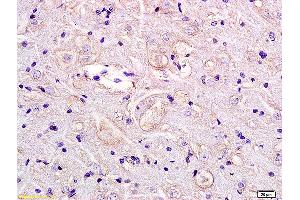 Formalin-fixed and paraffin embedded rat brain labeled with Anti GPR55 Polyclonal Antibody, Unconjugated (ABIN872750) at 1:200 followed by conjugation to the secondary antibody and DAB staining. (GPR55 Antikörper  (AA 141-240))
