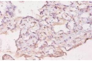 Immunohistochemistry of paraffin-embedded human placenta tissue using ABIN7177253 at dilution of 1:20 (GDF5 Antikörper  (AA 376-495))